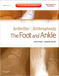 Arthritis dan Arthroplasty: The Foot and Ankle