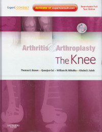 Arthritis dan Arthroplasty: The Knee