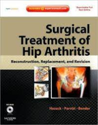 Image of Surgical Treatment of Hip Arthritis: Reconstruction, Replacement, and Revision