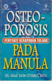 Osteoporosis: Penyakit Kerapuhan Tulang pada Manula